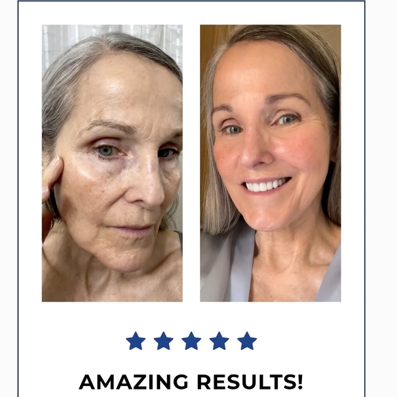 NWT Glamory Serum Infusions 5 Boxes - Picture 10 of 11